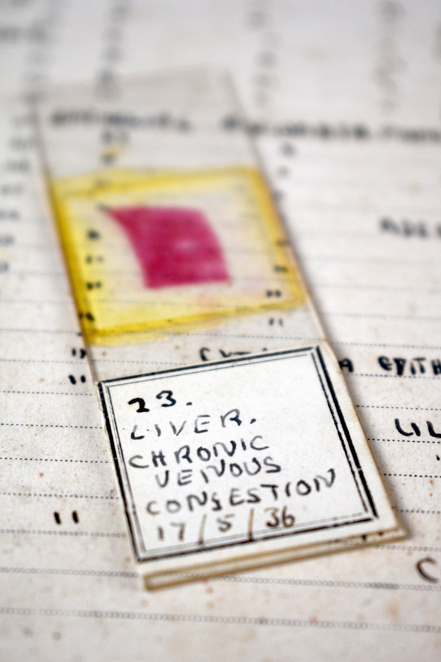 Doctor Bodenham's Pathology Slides