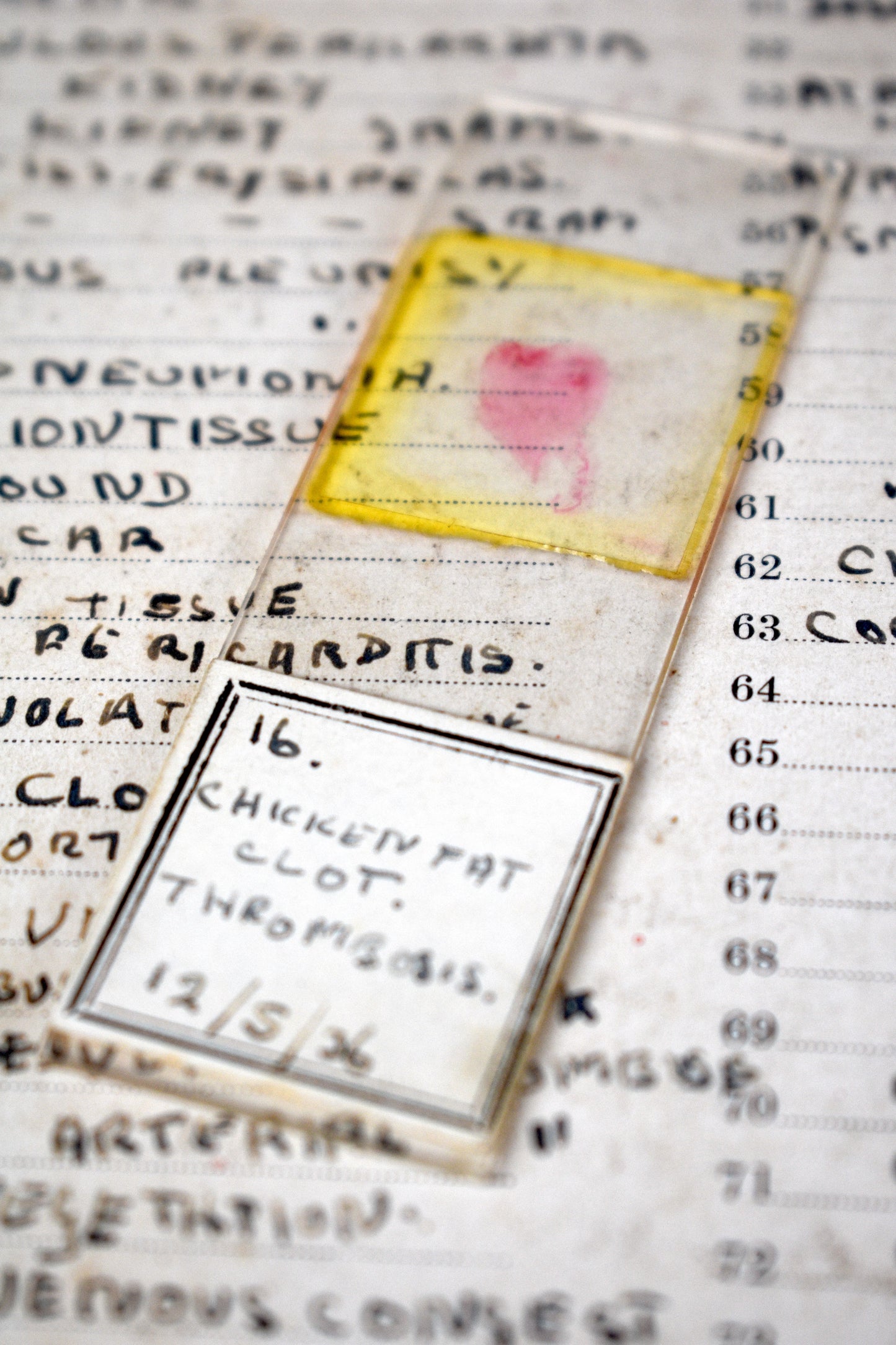 Doctor Bodenham's Pathology Slides